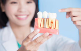 インプラントの模型を持つ歯科医師