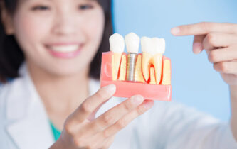 インプラントの模型を持つ歯科医師