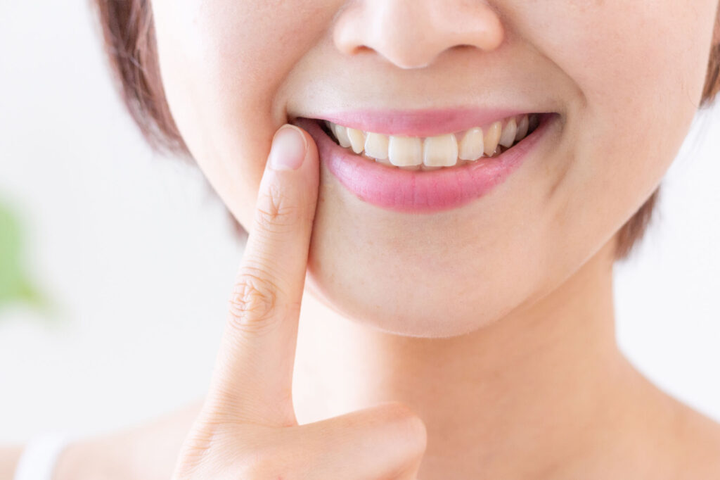 インプラントで美しく整った前歯