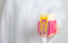 歯の模型を持つ歯科医