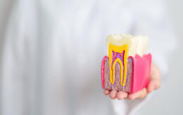 歯の模型を持つ歯科医