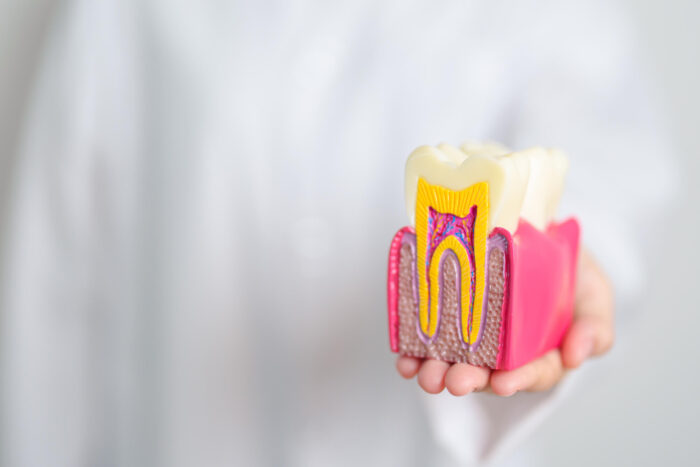 歯の模型を持つ歯科医