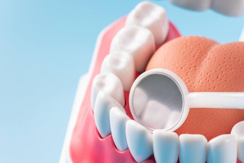 歯の模型とデンタルミラー