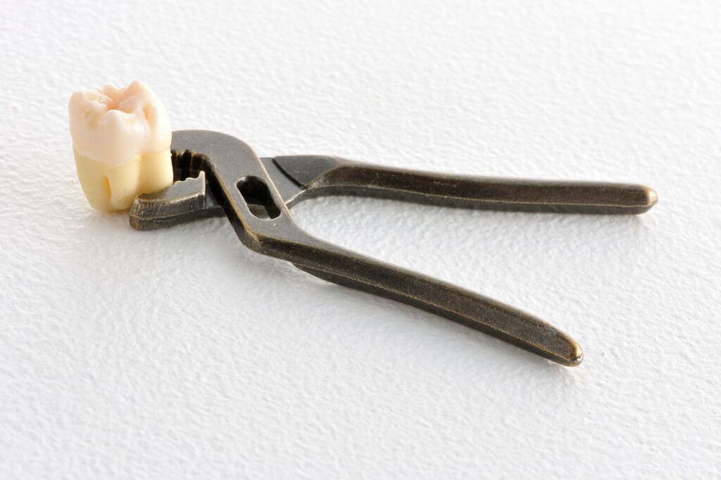 1本の歯の模型とペンチ、抜歯のイメージ
