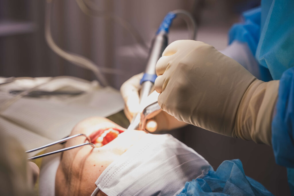 芝公園歯科のインプラント手術の様子